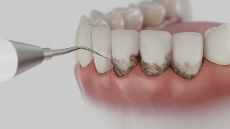 Reliable Teeth Cleaning And Checkup contractor in Fulton County County, PA by Dentist Open Now